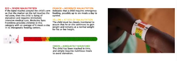 <ul><li><p>midbovenarmomtrek (mid upper arm circumference of MUAC)</p><ul><li><p>linkerbovenarm</p></li><li><p>interobserver variabiliteit tot 0,5cm = 3-5%</p></li><li><p>meting spieren en subcutaan vetweefsel</p></li><li><p>als MUAC daalt == aanwijzing voor wasting</p></li><li><p>redelijke stabiele waarden</p></li></ul><p></p></li><li><p>probleem:</p><ul><li><p>onderschat bij ouderen (ondervoeding)</p></li><li><p>overschat bij jonge kinderen (ondervoeding)</p></li></ul></li></ul><p>= oplossing: MUAC meer leeftijdsspecifiek maken</p><p></p><p>— ontwikkelingslanden: </p><ul><li><p>onderhuidsvetweefsel vaak dun (dicht bij evenaar = warm) — wnr lage waarden = afname spiermassa</p></li><li><p>kleurenbandje ipv meter</p></li></ul><p></p>