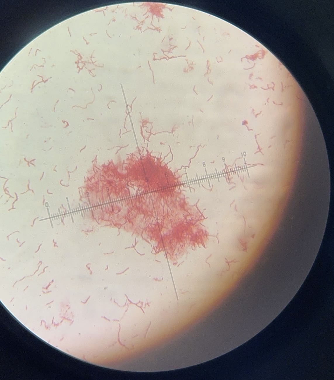<p><span>What is this organism?</span></p>