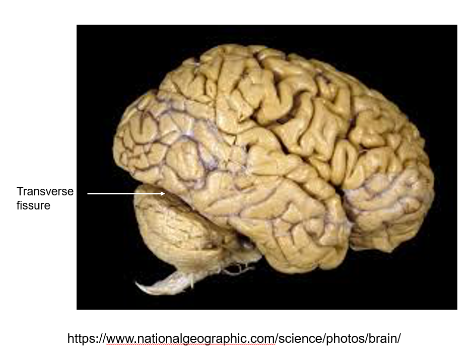 <p>Transverse fissure: separates cerebral hemispheres from cerebellum</p><p>Longitudinal fissure: separates cerebral hemispheres</p><p><em>tentorium cerebelli separates cerebral hemispheres from cerebellum; it lies in the transverse fissue</em></p>