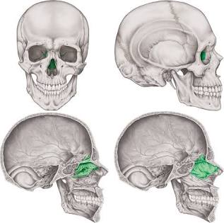 term image