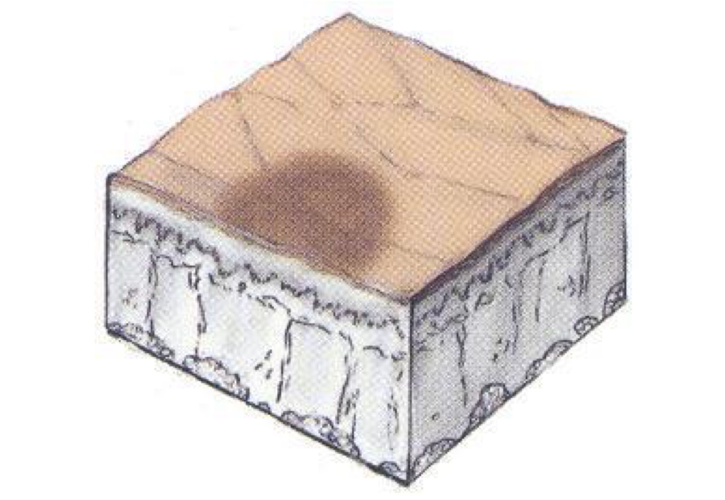 <p>what type of skin lesion is this? </p>