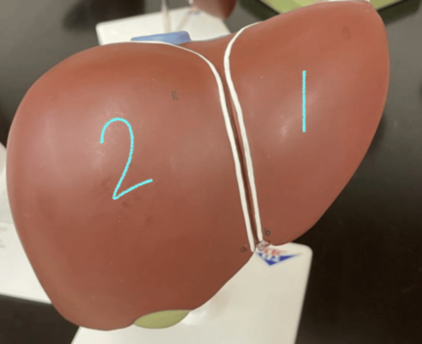 <p>which lobe of the liver is #1</p>