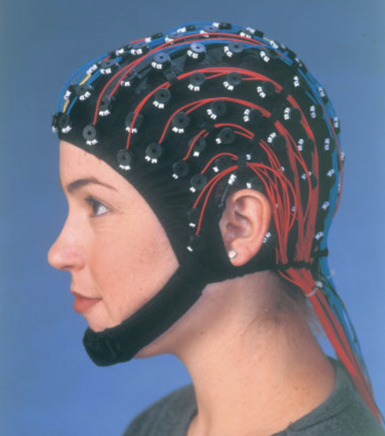 EEG (electroencephalogram) disadvantages

\-functional, direct