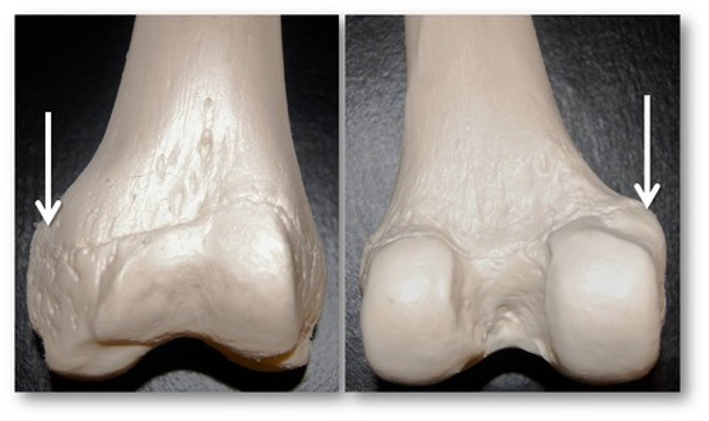 <p>projection above a condyle</p>