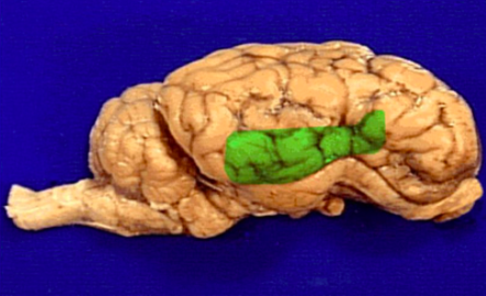 <p>Temporal Lobe</p>