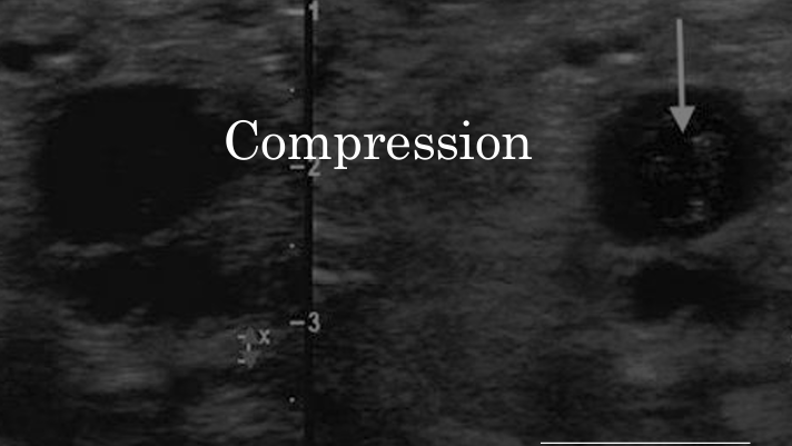 <p>which image has more compression?</p>