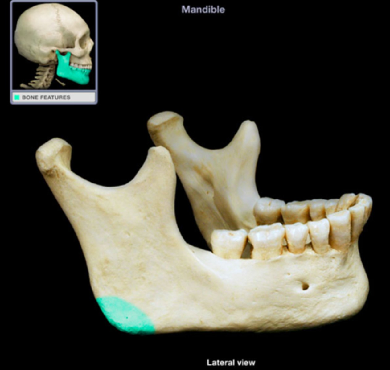 <p>What is shown on the image?</p>