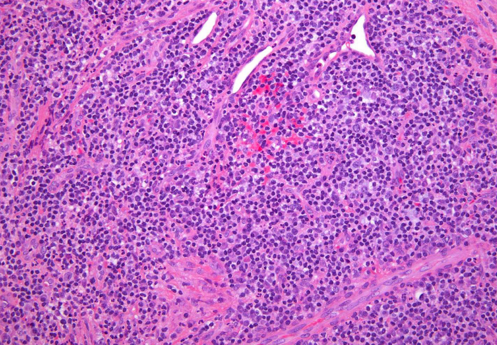 <p>which potential result of periapical inflammation?</p>