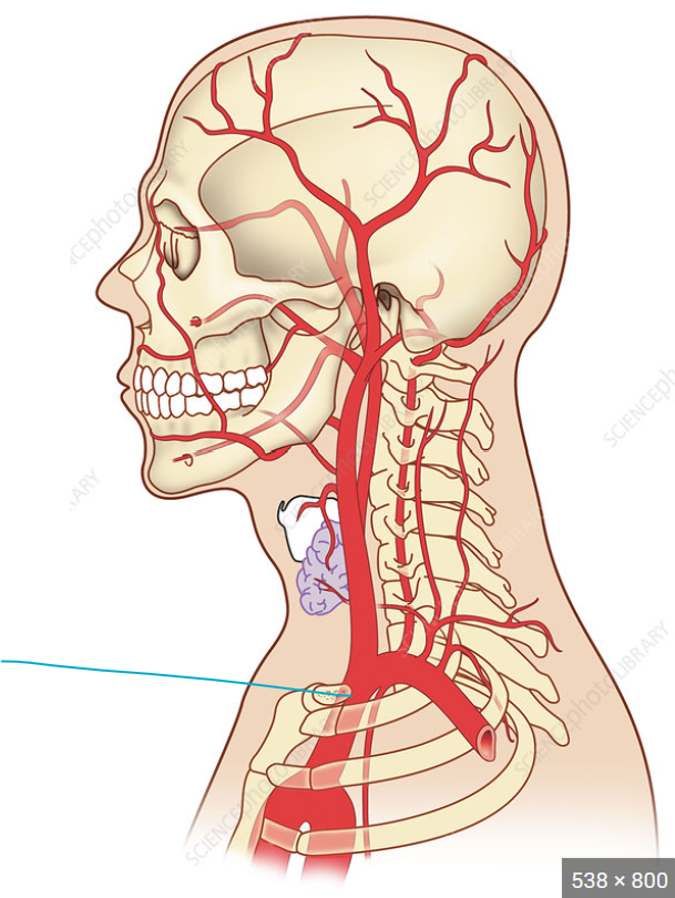 Brachiocephalic trunk