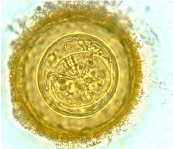 <p><span><em><span>Hymenolepis diminuta</span></em><span> egg</span></span></p>