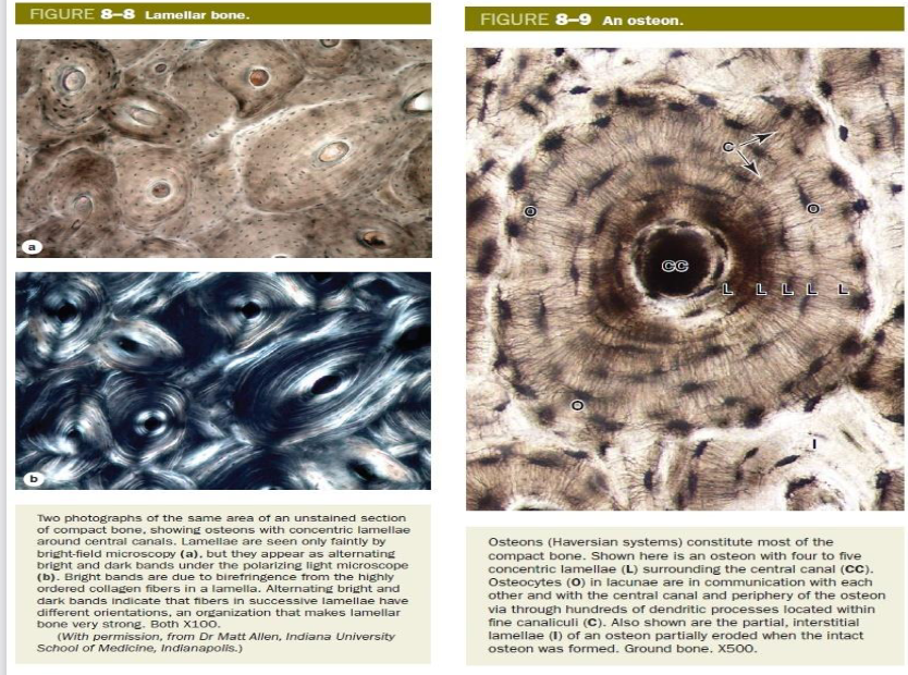 <p><strong>botweefsel: </strong>osteon/ systeem van Havers</p>