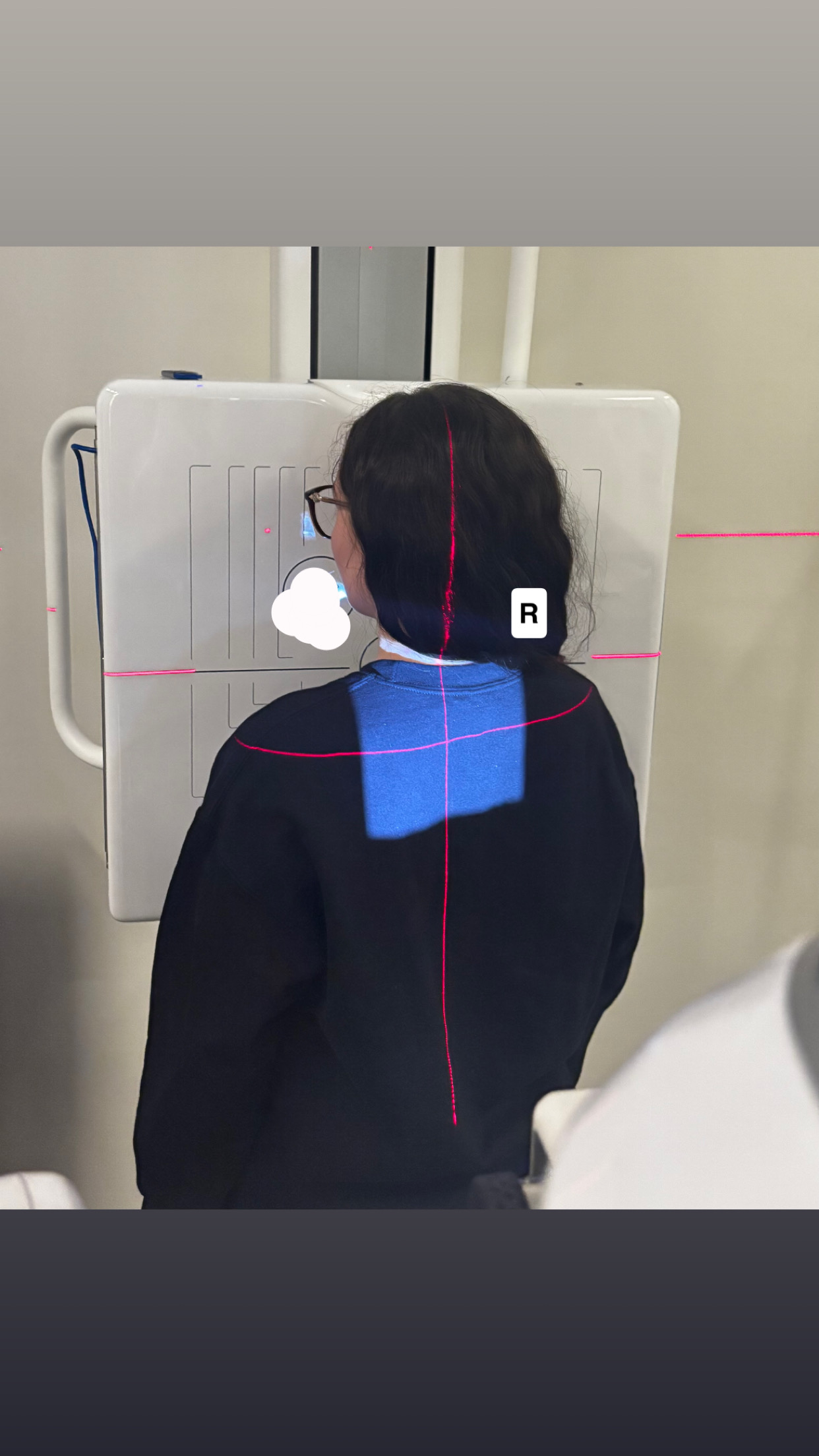 <p>SC joints- RAO</p>