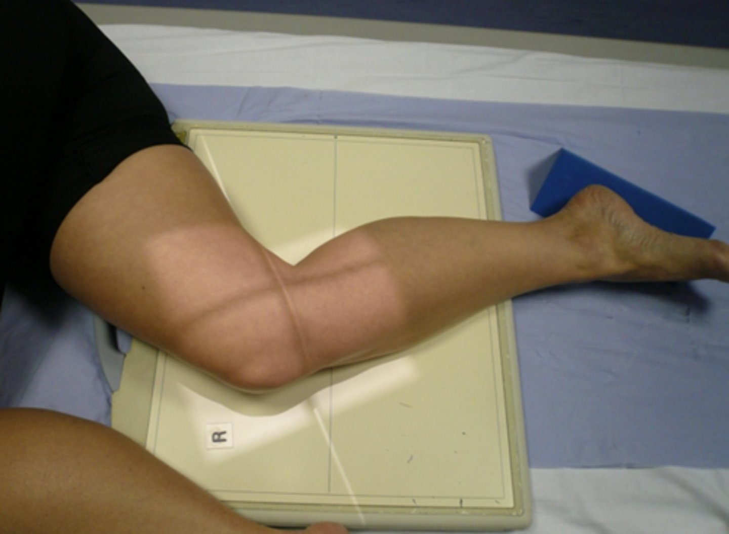 <p>1. Patient lies on the affected side to be examined and the knee is flexed at either 45 or 90 degrees.</p><p>2. The unaffected leg is brought in front of the one being examined.</p><p>3. A small pad should be placed under the ankle joint to ensure the tibia is parallel to the x-ray couch.</p><p>4. The femoral condyles of the knee being examined should be superimposed.</p>