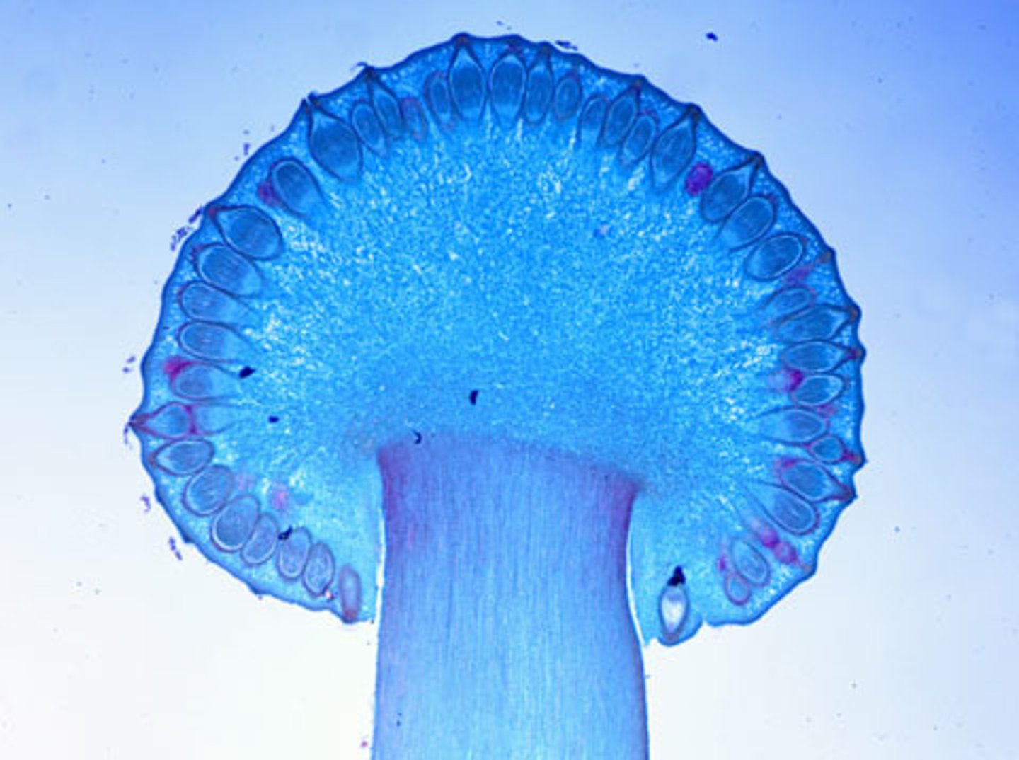 <p>flask-shaped fruiting structures containing asci with ascospores</p>
