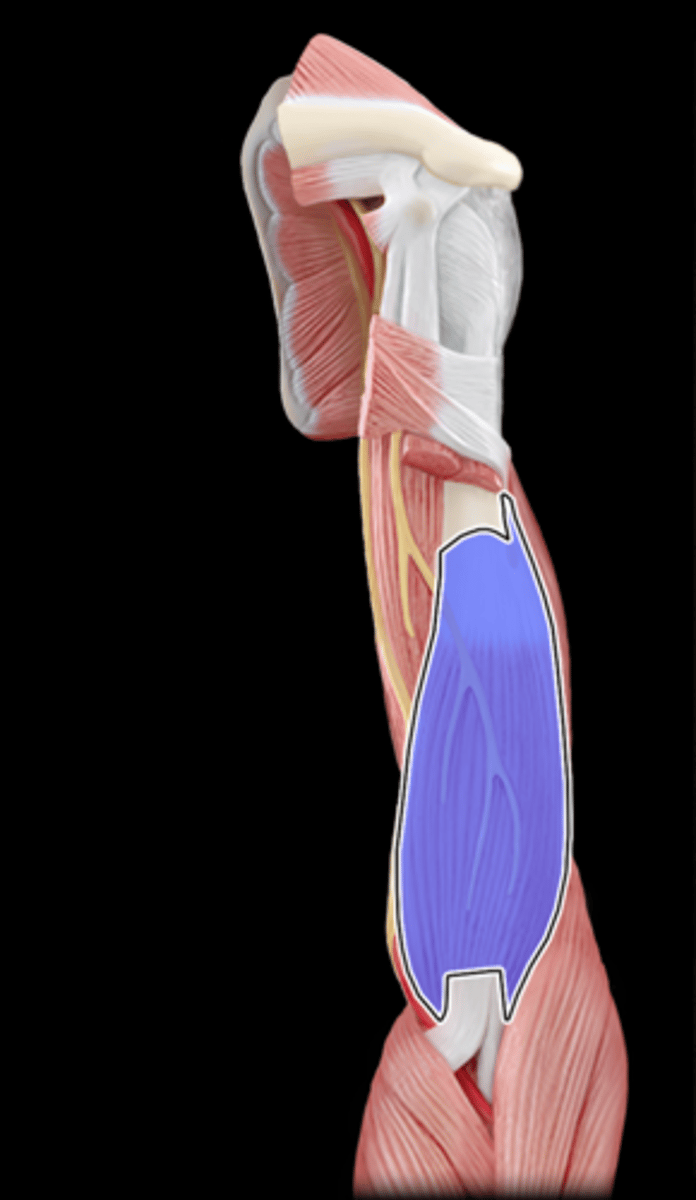 <p>What Muscle Is Highlighted?</p>