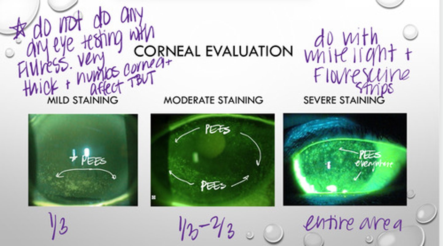 <p>What is the difference between mild, moderate, and severe staining on corneal evaluation?</p>