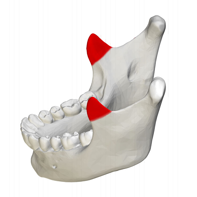 <p>What bone structure is the highlighted area?</p>