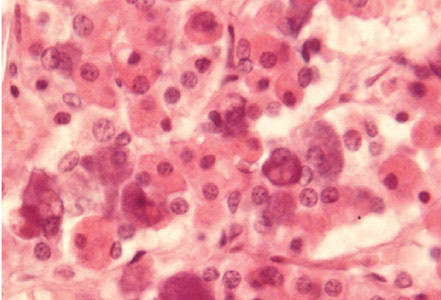 <p>Identify endocrine organ, tissue type and type of cells</p>