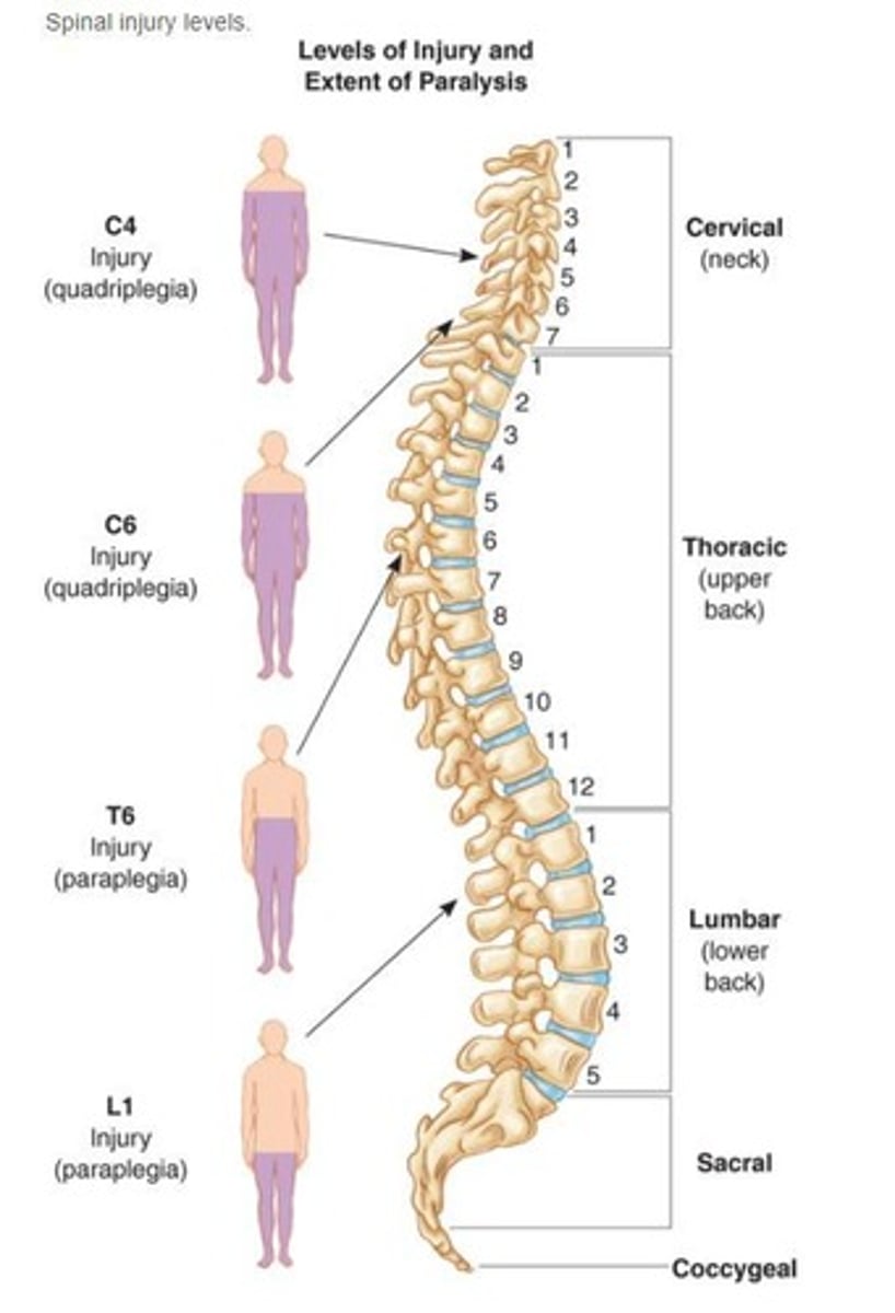 <p>A standardized tool used to classify the severity of a spinal cord injury (A-E/Complete-Normal)</p>