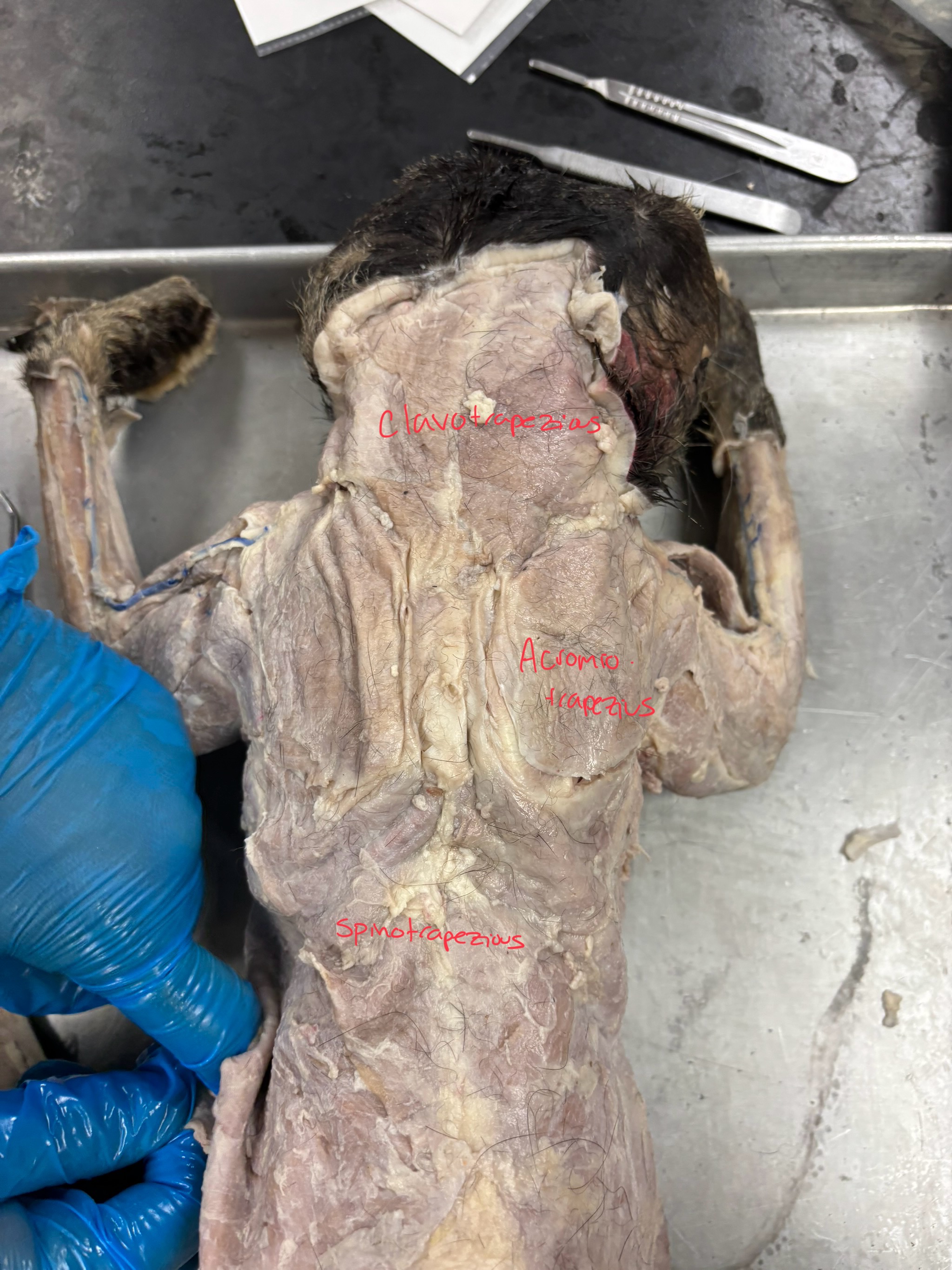 <p>Clavotrapezius: Protraction of arm at shoulder</p><p>acromiotrapezius: adduct and stablize scapula</p><p>spinotrapezius: pulls scapula up and back</p>