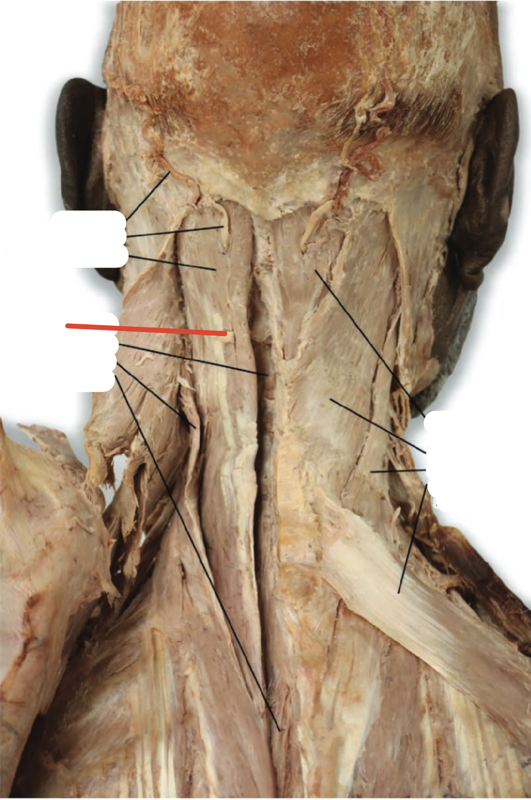Identify the structure (red line)