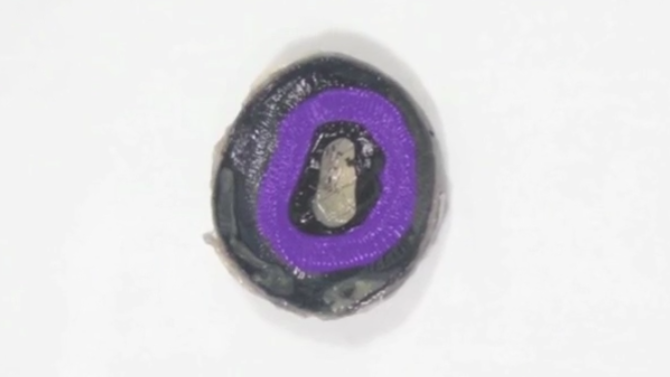 <p>Cilliary body </p>
