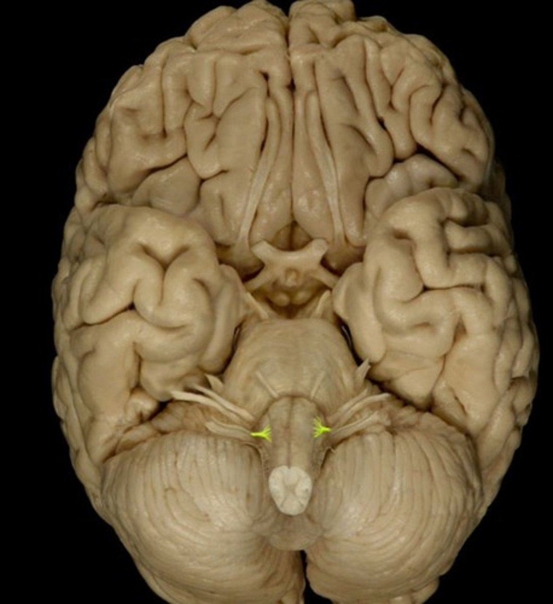 <p>name this cranial nerve</p>