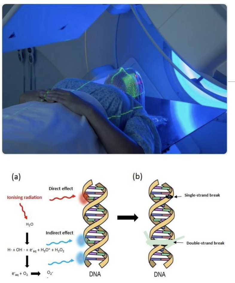 <p>Targeted Delivery of ionizing radiation to Cancer leading to DNA damage</p><p>Side Effect:</p><ul><li><p>Bone marrow suppression</p></li><li><p>Nausea vomit</p></li><li><p>Hair loss</p></li><li><p>Fatigue</p></li><li><p>Secondary Cancer</p><ul><li><p>To minimize damage try to use smaller dose</p></li></ul></li></ul><p></p>