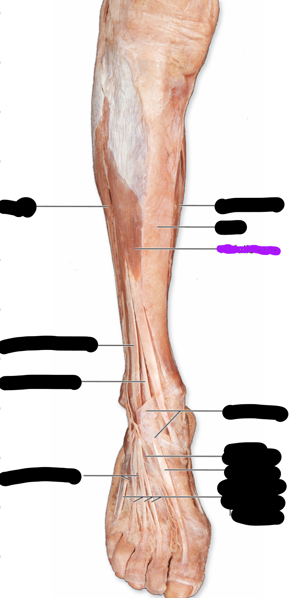 <p>Function?</p>