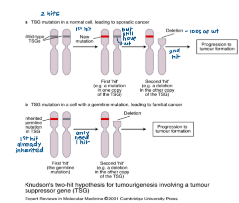 <p>Inherited retinoblastoma vs sporadic retinoblastoma</p><ul><li><p>inherited cases <strong>occur earlier</strong> </p></li><li><p>inherited cases developed in <strong>both eyes </strong></p></li></ul><p></p><p>“Two hits” needed- in inherited cases, first hit already present (inherited mutation) so only one more needed (deletion)</p><p></p>