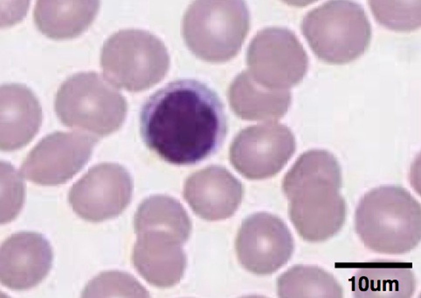 <p>helper: adaptive response</p><p>cytotoxin: kill cells</p>