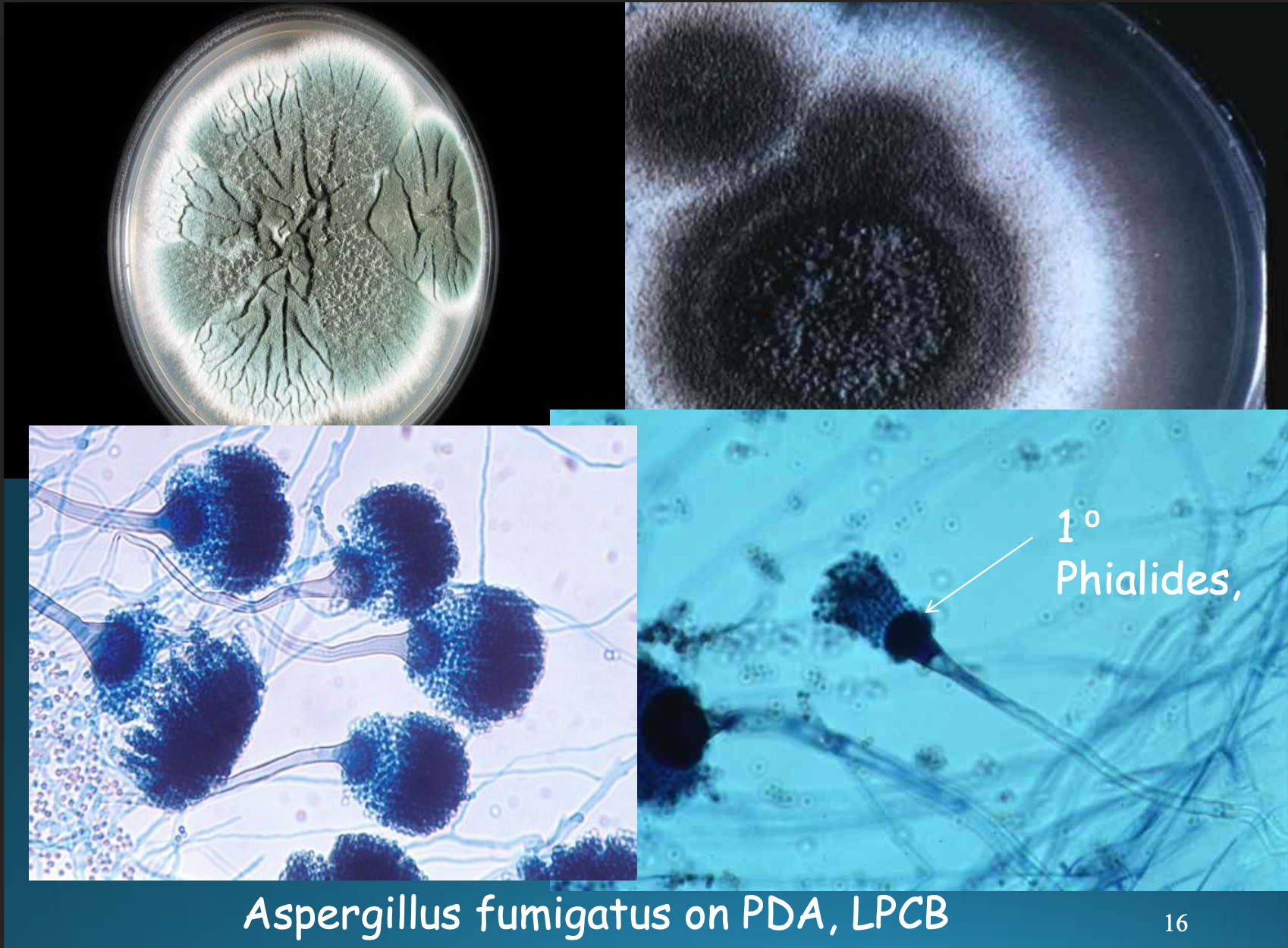 <p>Aspergillus fumigatus: Microscopically (septate hyphae, conidiophore, phialides on the vesicle) (1 phialide on ½, or ⅓ of the vesicle). Macroscopically (flat, smoky gray, green w white edge, powdery)</p>