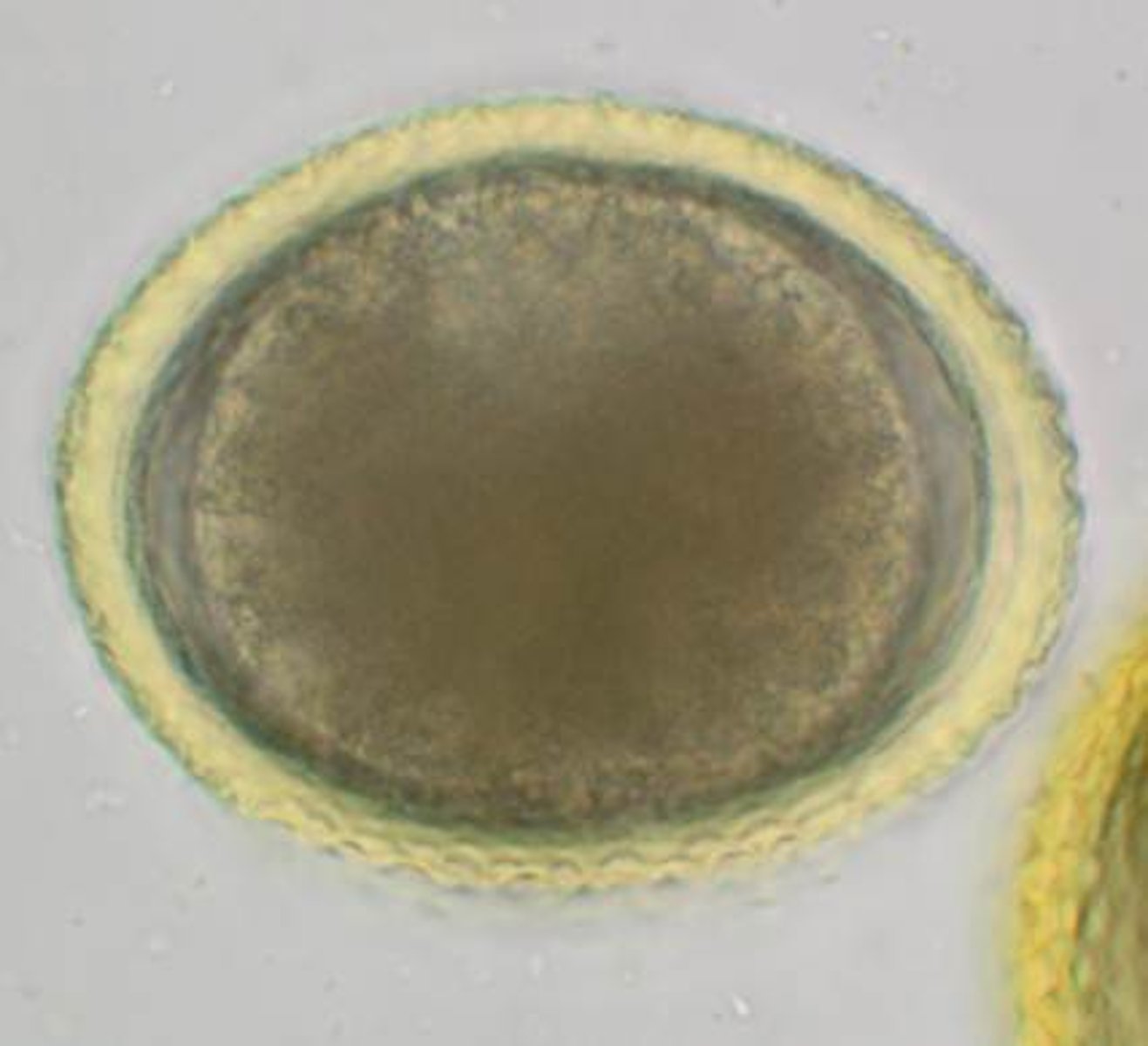 <p>Identify this egg found on the fecal examination of a 6 week-old puppy with a pot-bellied appearance. The egg measures approximately 85 um in diameter.</p>