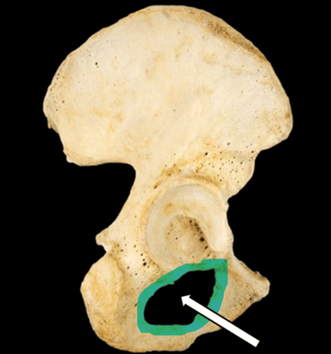 <p>name the part</p>
