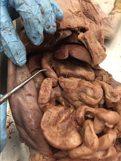 <p>What part of the small intestine is indicated in the image</p>