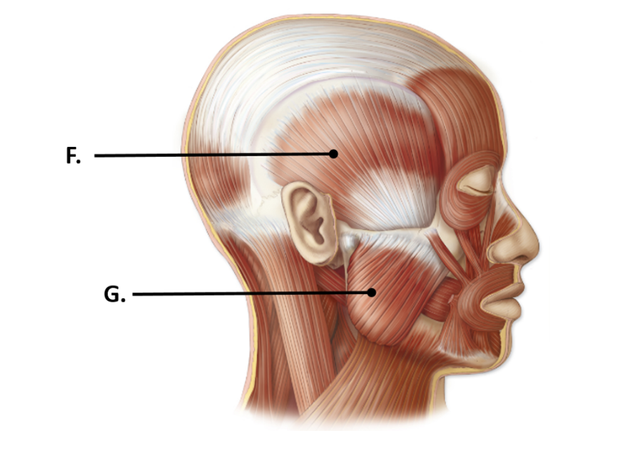 <p>F; covers temporal bone</p>
