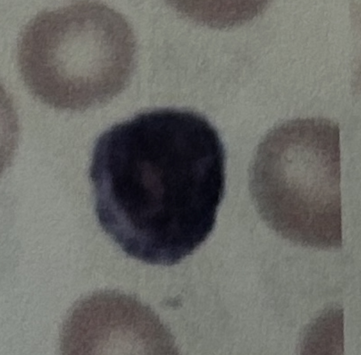<p>WBC</p>