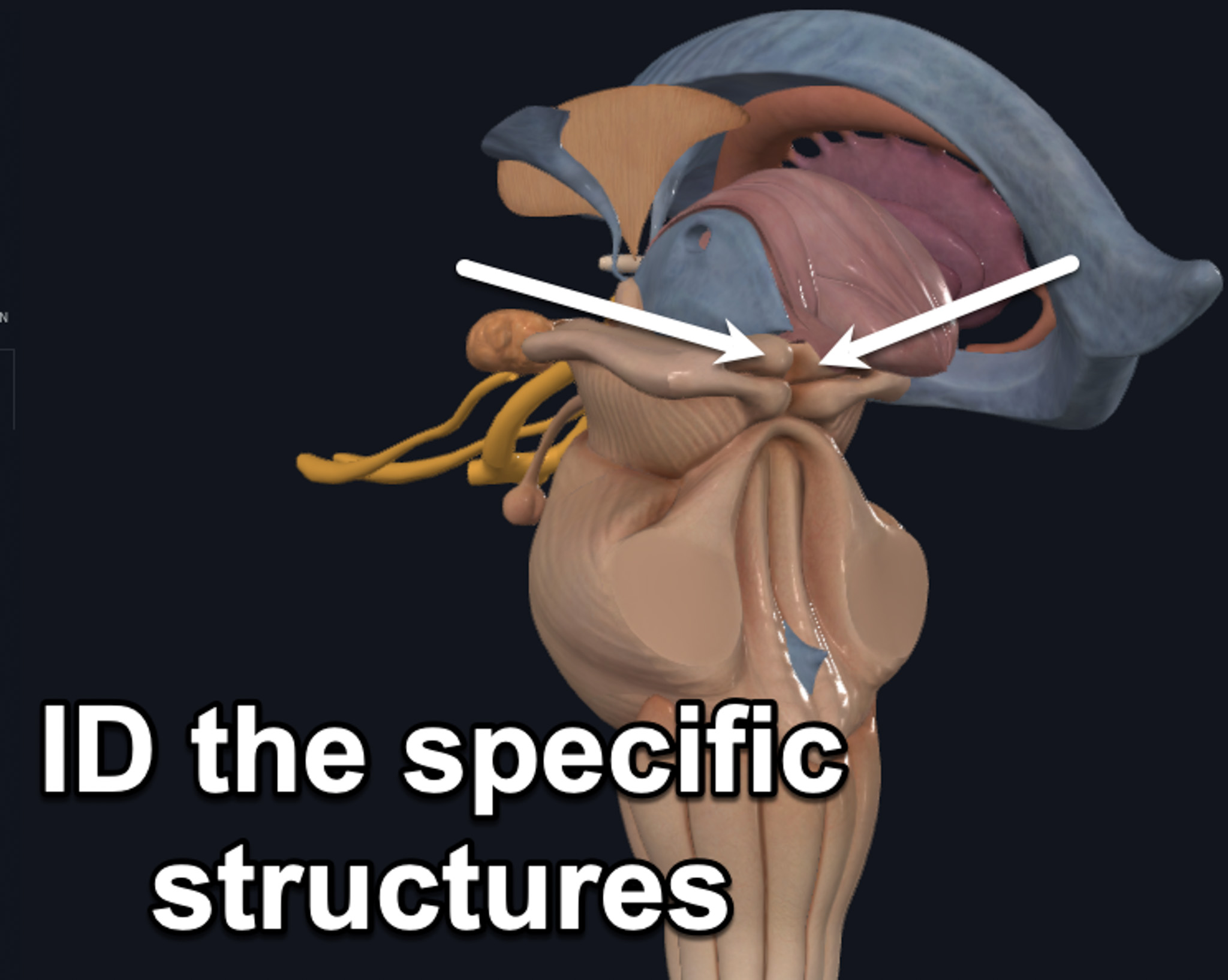 term image