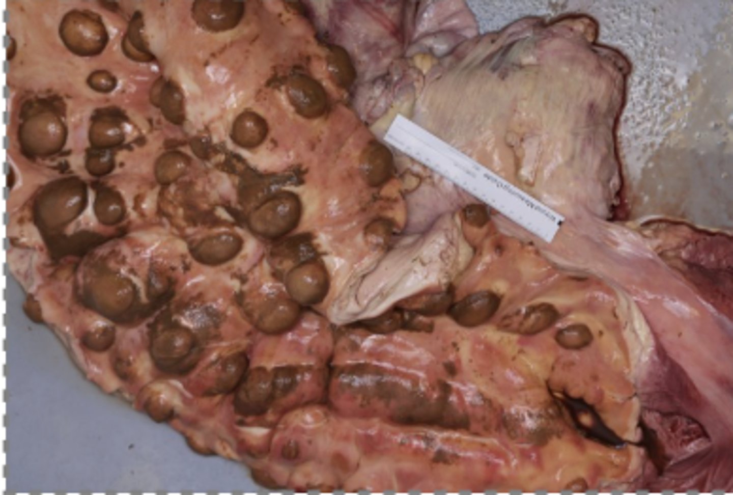 <p>What has caused the gross appearance of this bovine liver?</p>