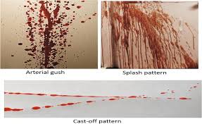 <p>arterial spray spatter</p>