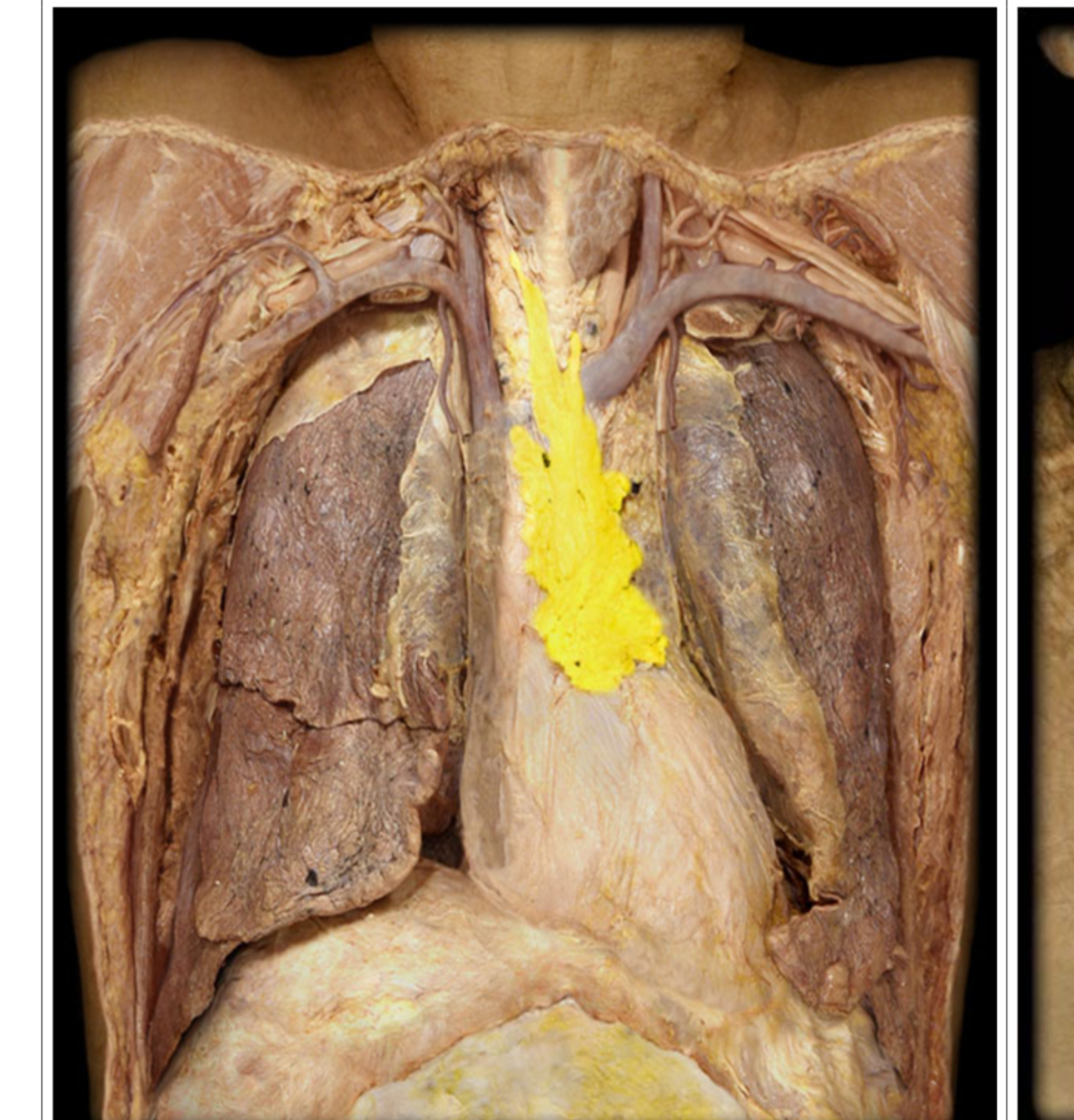 <p>What gland is this</p>