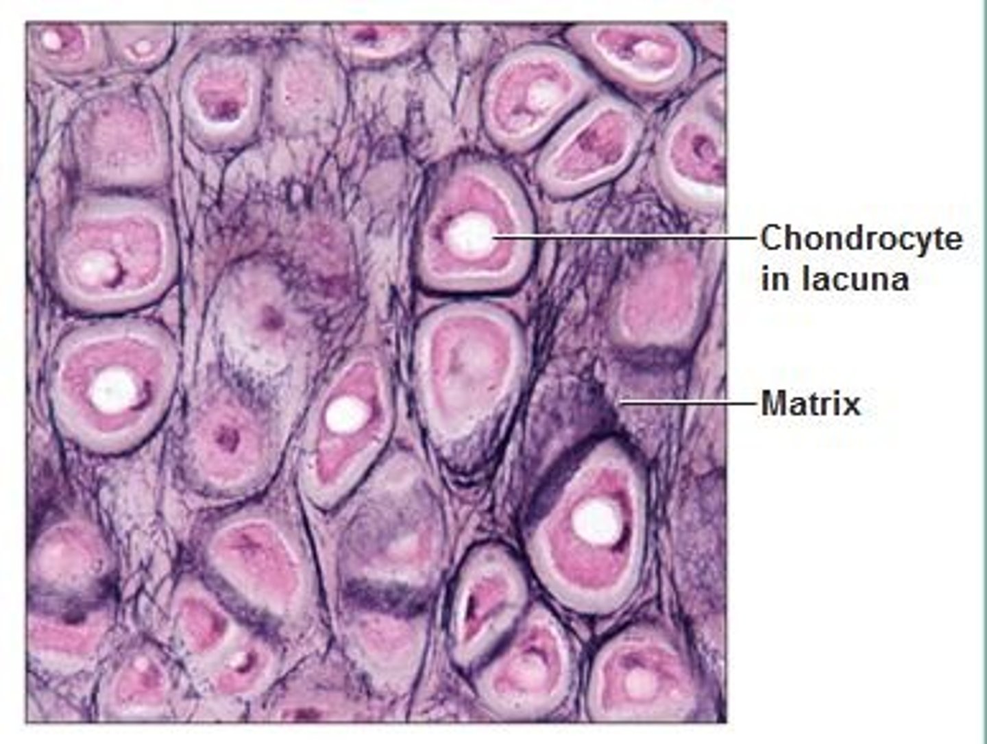 <p>Netlike pattern of elastic fibers around chondrocytes</p><p>Perichondrium</p><p>Location: external ear, epiglottis, auditory canal</p><p>Function: flexible framework</p><p>Matrix mostly composed of elastic protein fibers (matrix, spider web looking) - there are lacunas, and inside there chondrocytes</p>