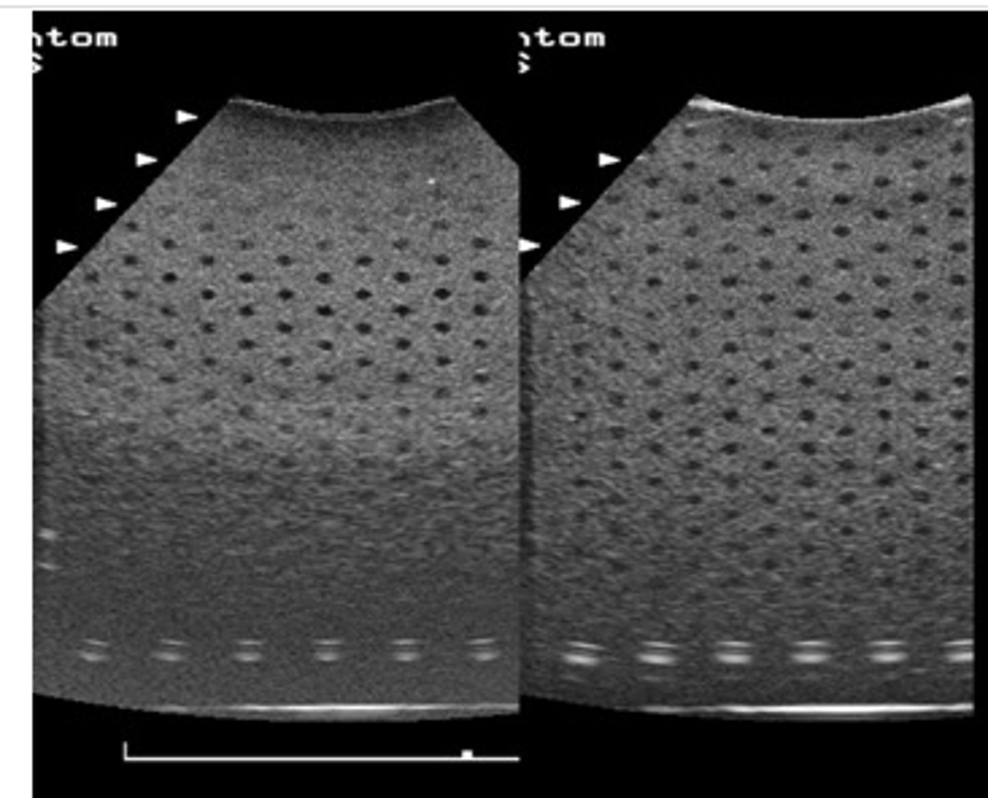 <p>1.5D or multirow array</p>