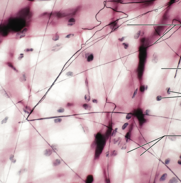 <p>function- wraps/cusions organs, has macrophages, helps w/ inflammation, holds/conveys tissue fluid </p><p>location- under epi, packages organs, surrounds capillaries </p>