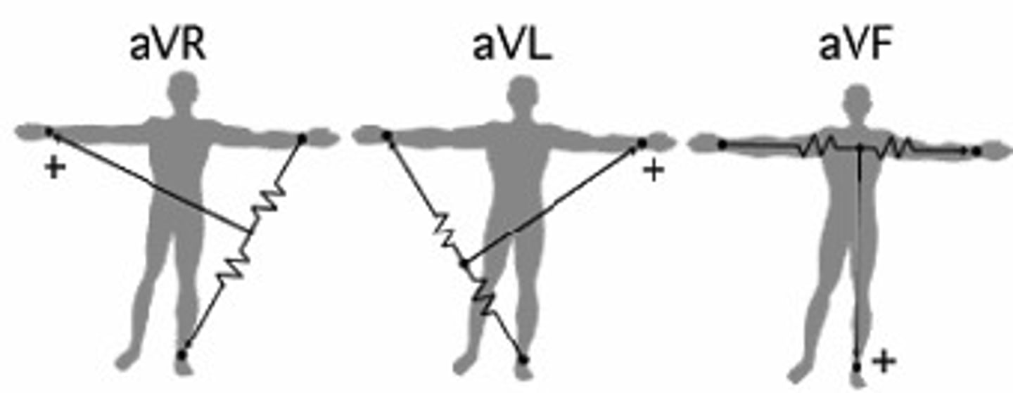 <p>Unipolar leads made by combining 2 of the 3 limb leads 2 make a + electrode</p>