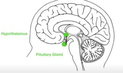 <p>Tuberoinfundibular Pathway</p><ul><li><p>DA from <span style="color: red;"><strong>Hypothalamus (HT) → Pituitary Gland (PG) </strong></span>→ Prolactin (PL)</p><ul><li><p><span style="color: red;"><strong>LOW(ered) DA = HIGH PROLACTIN (vice versa)</strong></span></p><ul><li><p>S/S = amenorrhea (reduced FSH) + galactorrhea</p></li></ul></li></ul></li></ul><p></p>