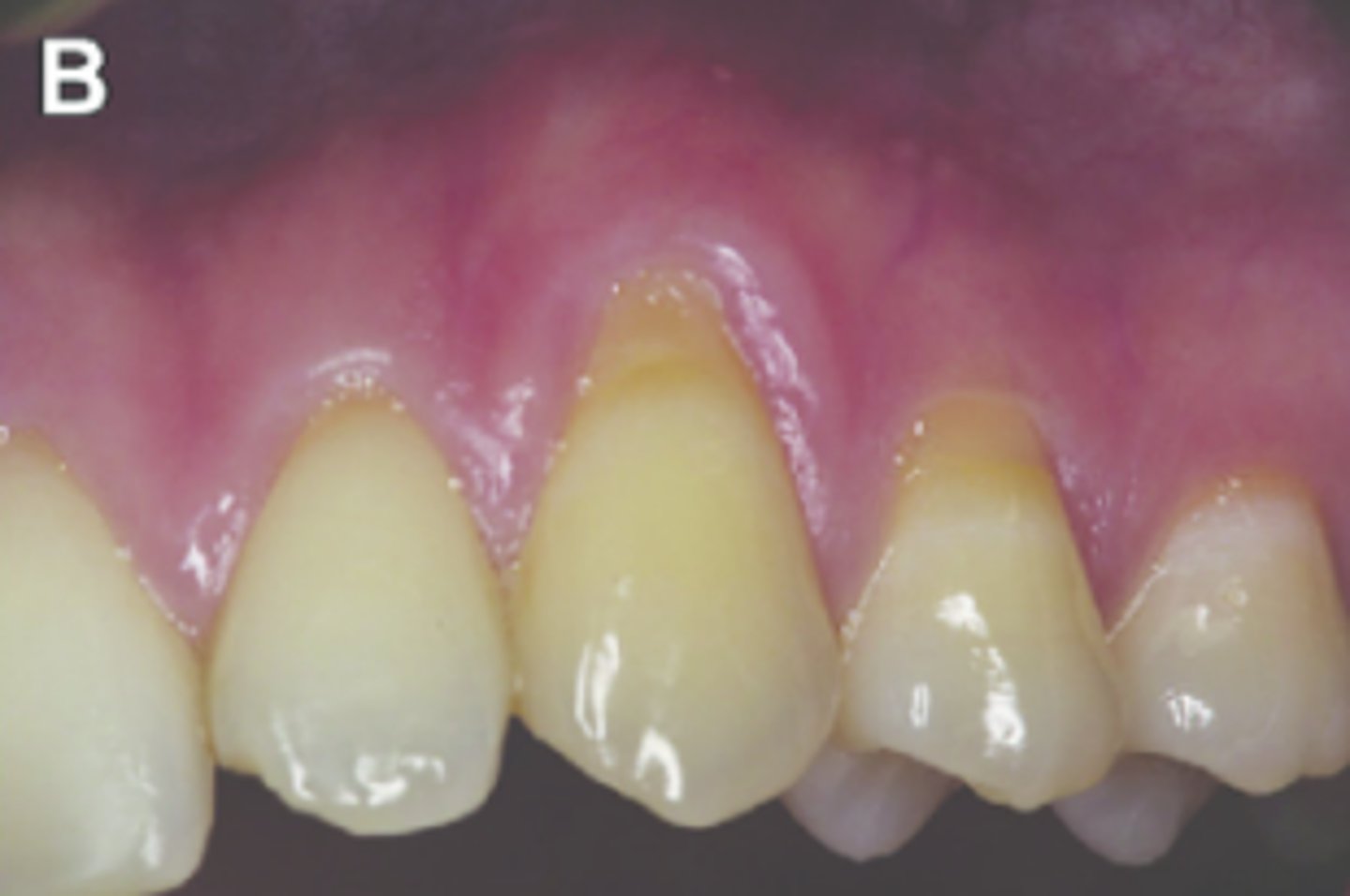 <p>what biotype is this and why?</p>