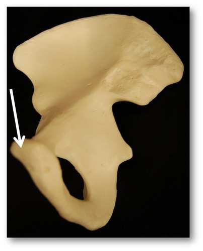 Name this specific region of the pelvic bone.
