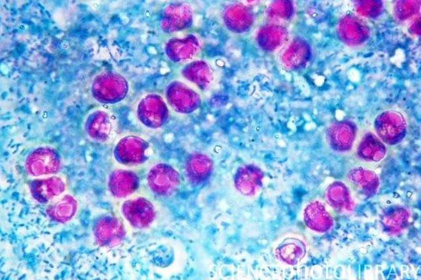 <p>Stained fecal smear</p>