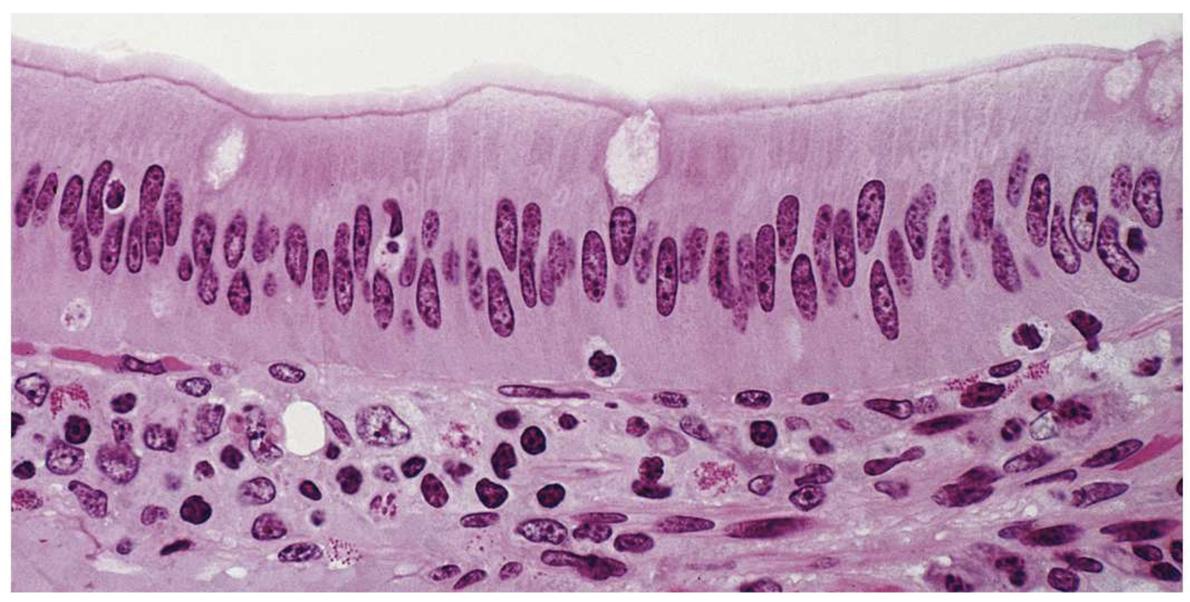 <p>Simple columnar epithelium.</p>